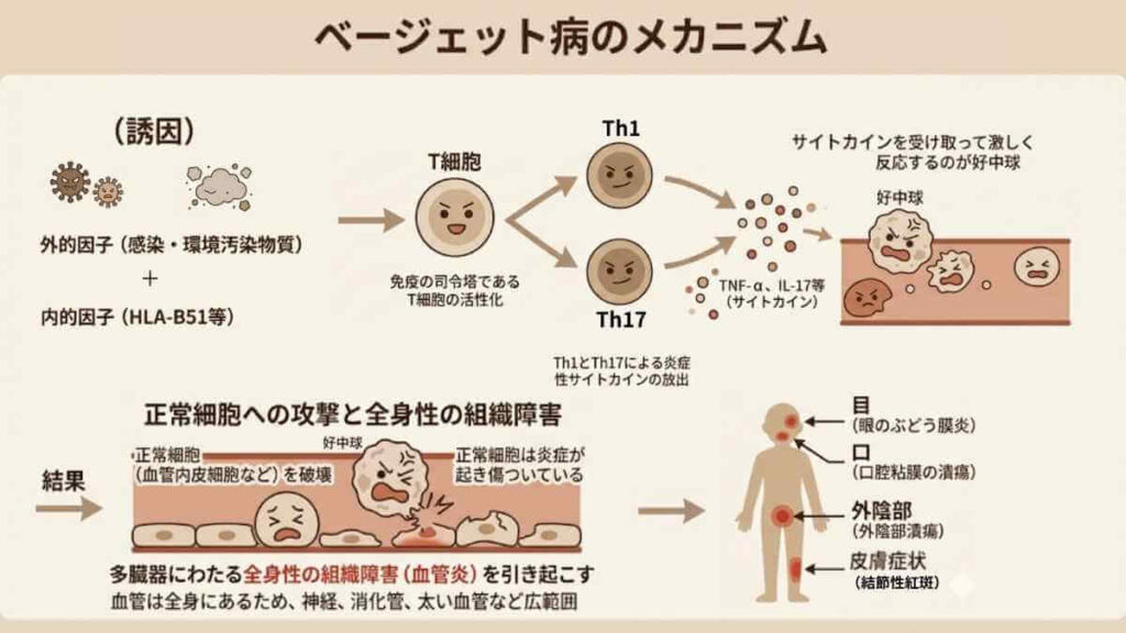 ベーチェット病のメカニズムを図解。外的因子(感染・環境汚染物質)と内的因子(HLA-B51等)がT細胞を活性化し、Th1、Th17細胞からTNF-αやIL-17などのサイトカインが放出され、好中球が血管内皮細胞などの正常細胞を攻撃して全身性の組織障害(血管炎)を引き起こす流れを解説しています。